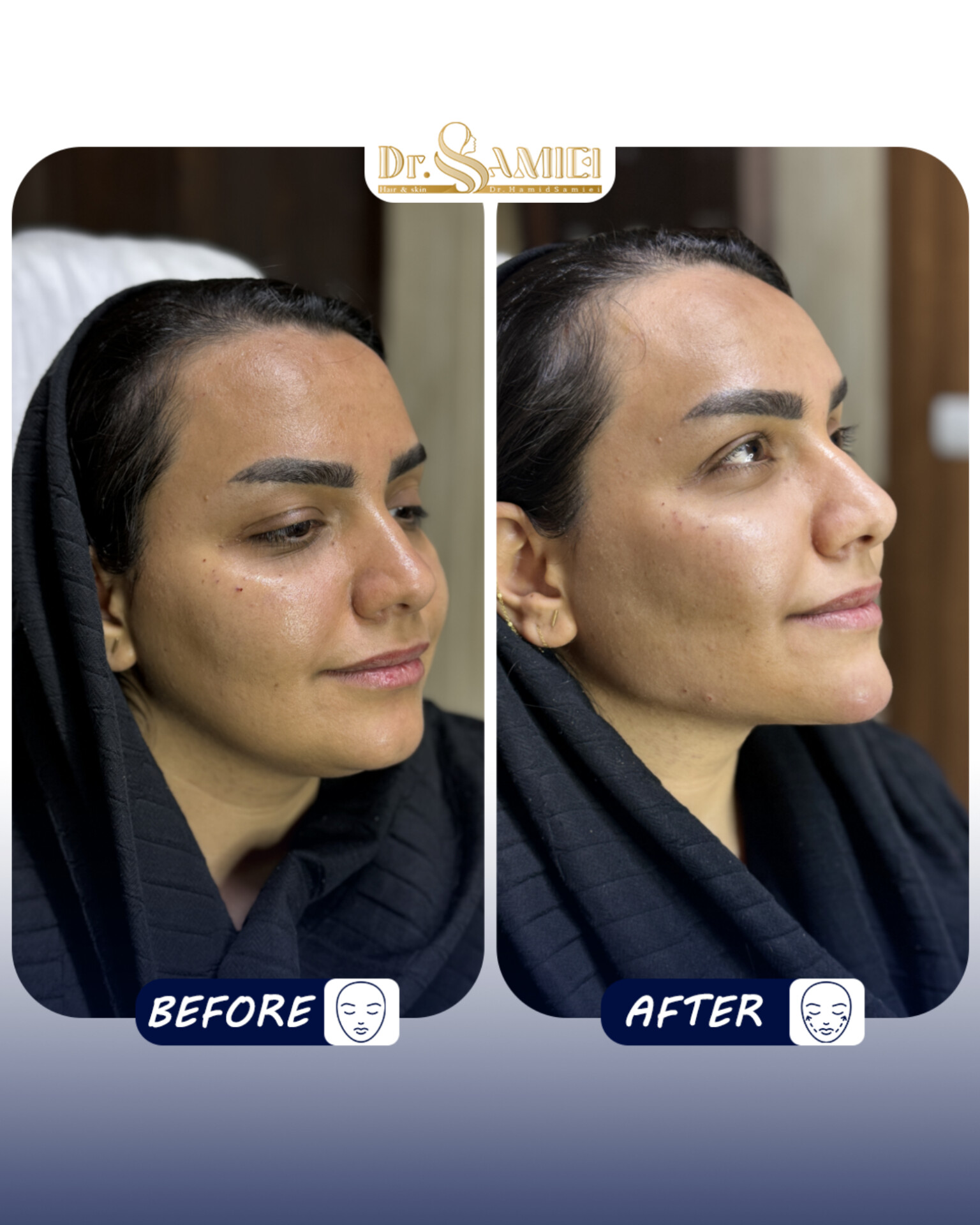 دکتر حمید سمیعی👨🏻‍⚕️پزشک زیبایی - تصویر گالری