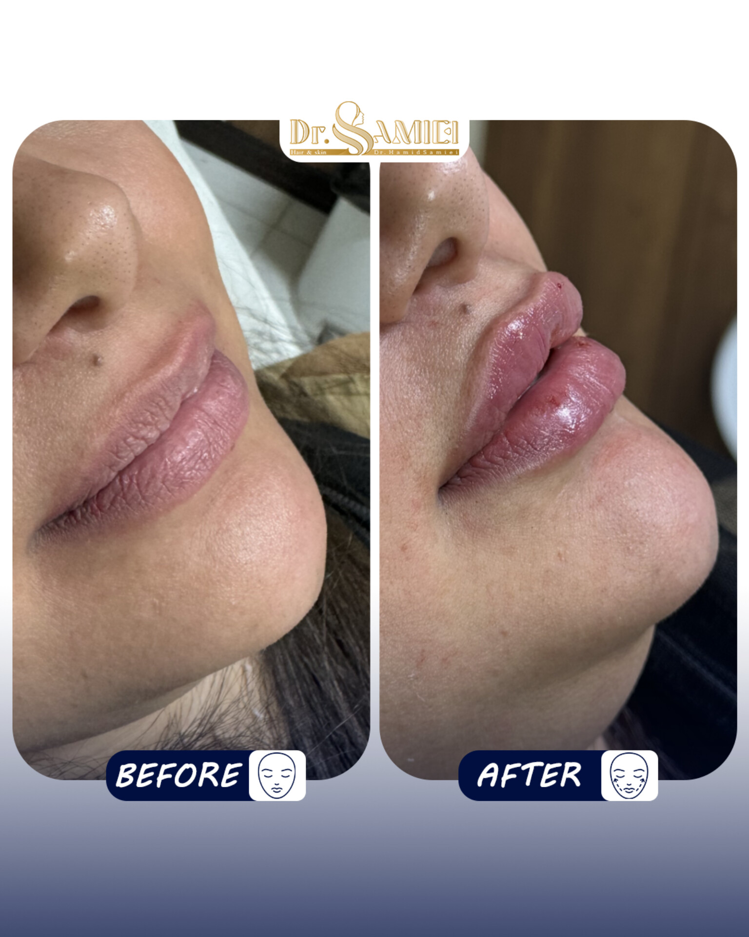 دکتر حمید سمیعی👨🏻‍⚕️پزشک زیبایی - تصویر گالری