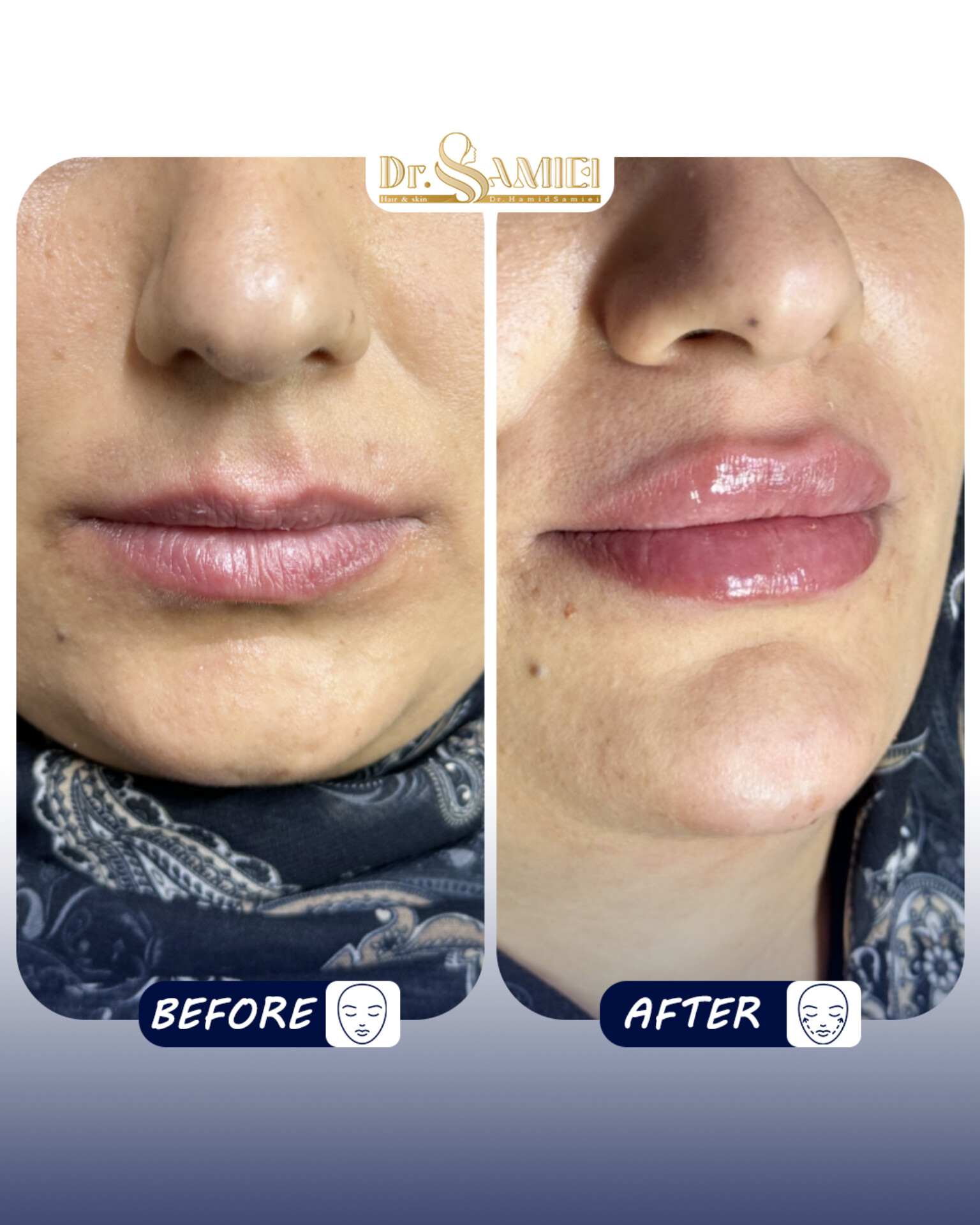 دکتر حمید سمیعی👨🏻‍⚕️پزشک زیبایی - تصویر گالری