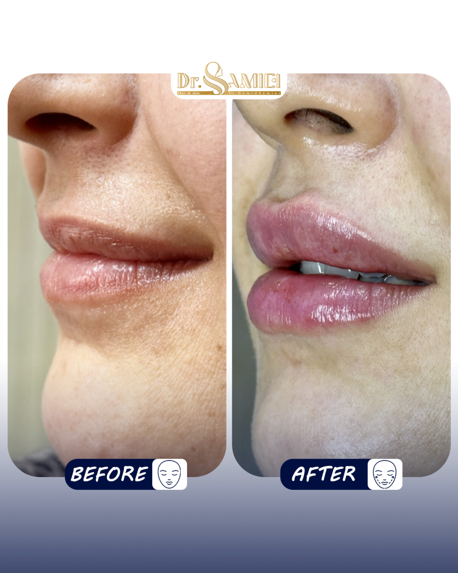 دکتر حمید سمیعی👨🏻‍⚕️پزشک زیبایی - تصویر گالری